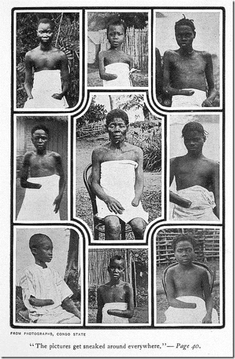 MutilatedChildrenFromCongo